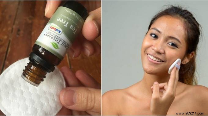 How to Quickly Banish Acne Pimples with Lavender Essential Oil