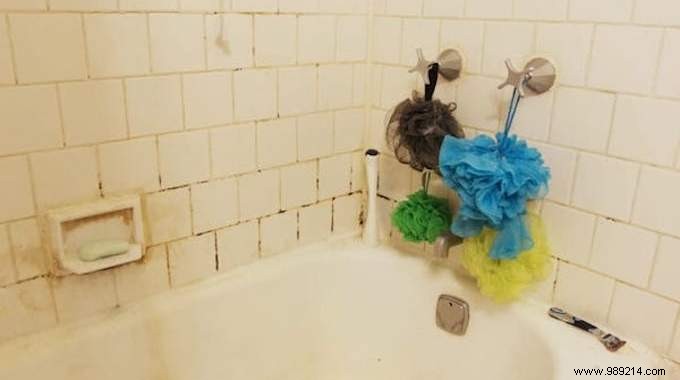 Dermatologists Warn: Ditch Your Shower Puff Immediately for Healthier Skin