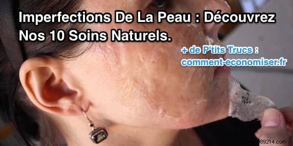 10 Proven Natural Remedies for Skin Blemishes and Imperfections