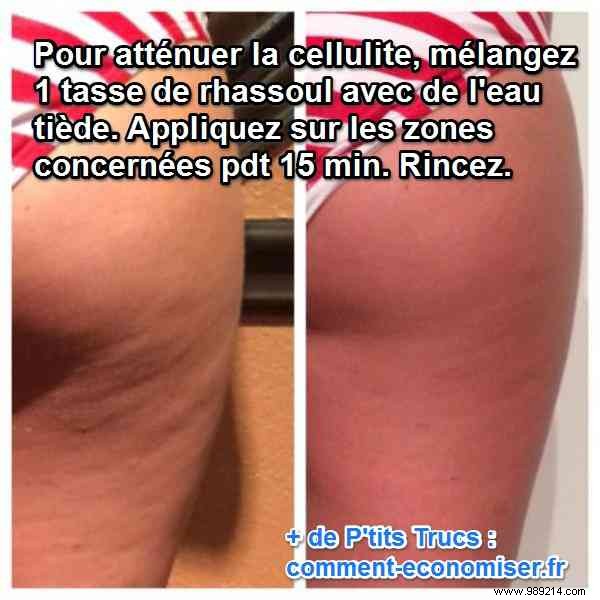 16 Proven Natural Remedies to Reduce Cellulite Effectively