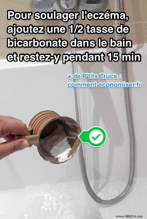 Soothing Eczema Itch with Baking Soda Baths: A Doctor-Recommended Natural Remedy