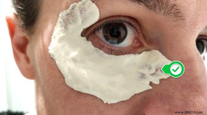 Banish Under-Eye Bags Naturally: Simple White Clay Poultice Remedy