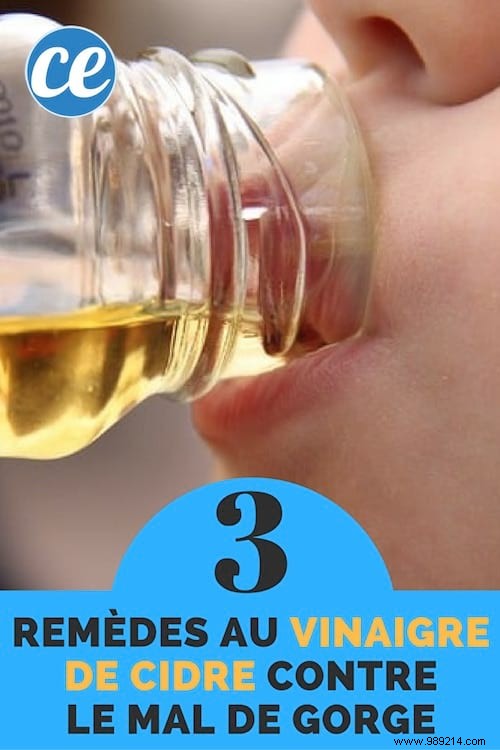 3 Proven Apple Cider Vinegar Remedies for Fast Sore Throat Relief