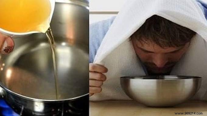 Clear a Stuffy Nose Fast: Simple Apple Cider Vinegar Vapor Remedy