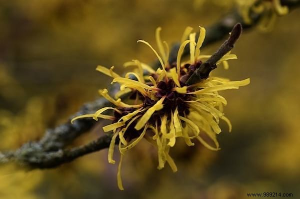 10 Natural Remedies to Reduce Varicose Vein Symptoms and Improve Circulation