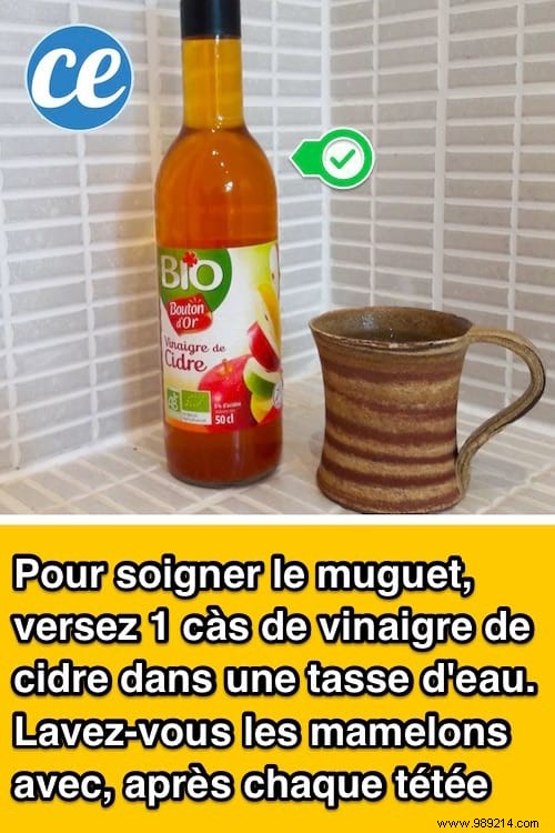 Effective Apple Cider Vinegar Remedy for Baby Oral Thrush: A Trusted Natural Approach