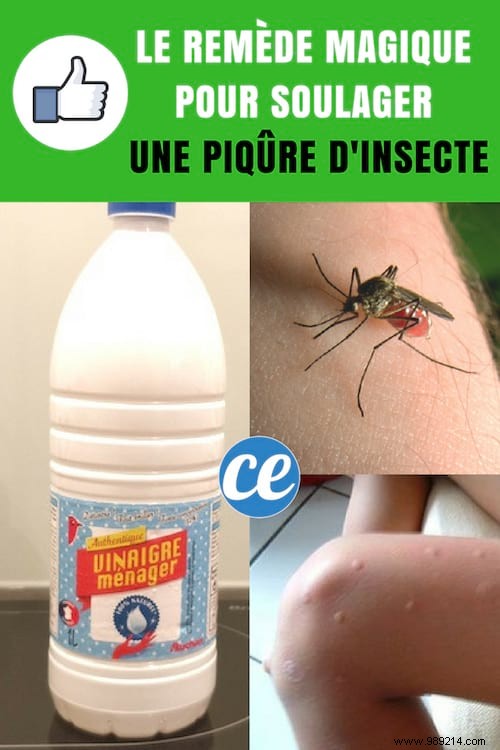 Soothe Itchy Insect Bites Fast with White Vinegar: Proven Natural Remedy