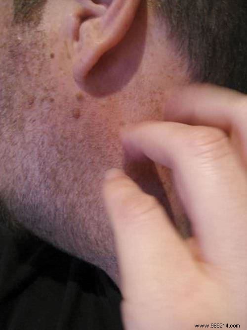 75 Proven Vinegar Uses: Expert Hacks for Cleaning, Health, Home, and More