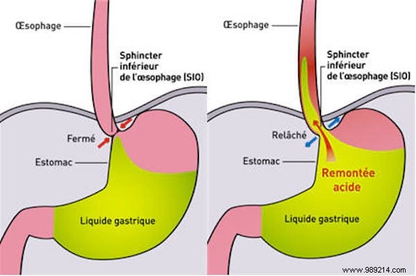 75 Proven Vinegar Uses: Expert Hacks for Cleaning, Health, Home, and More
