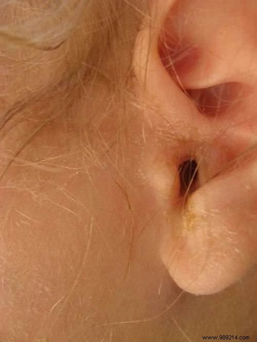 75 Proven Vinegar Uses: Expert Hacks for Cleaning, Health, Home, and More