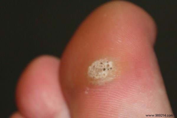 75 Proven Vinegar Uses: Expert Hacks for Cleaning, Health, Home, and More