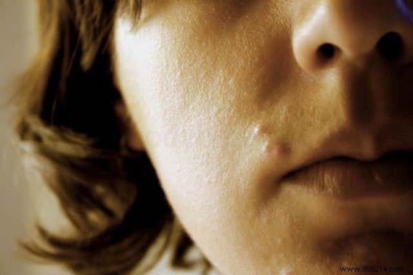 75 Proven Vinegar Uses: Expert Hacks for Cleaning, Health, Home, and More