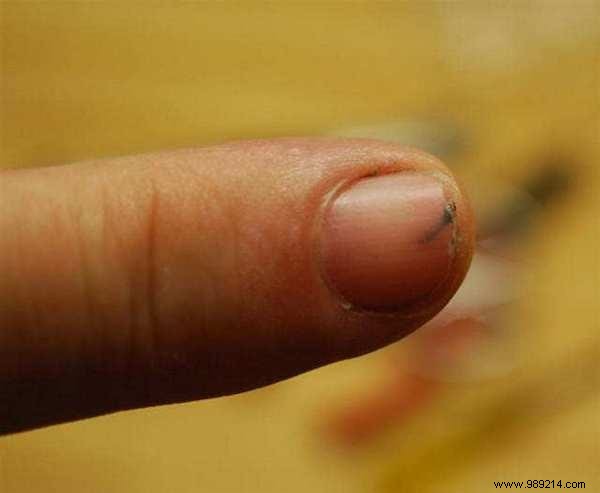 75 Proven Vinegar Uses: Expert Hacks for Cleaning, Health, Home, and More