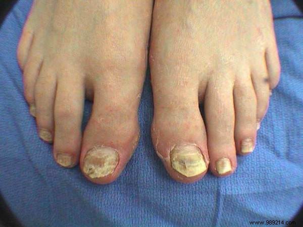 75 Proven Vinegar Uses: Expert Hacks for Cleaning, Health, Home, and More