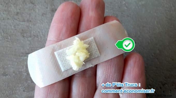 Proven Garlic Remedy for Fast Wart Removal: A Time-Tested Natural Approach