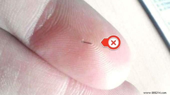 Easy Home Remedy: Remove Deeply Embedded Thorns from Fingers or Feet with Hot Salt Water