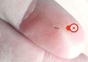 Easy Home Remedy: Remove Deeply Embedded Thorns from Fingers or Feet with Hot Salt Water