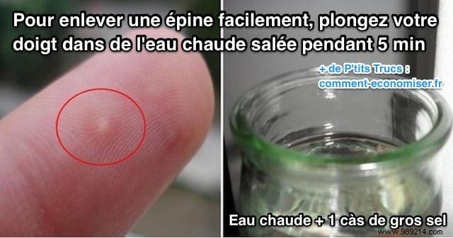Easy Home Remedy: Remove Deeply Embedded Thorns from Fingers or Feet with Hot Salt Water