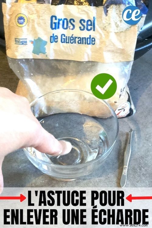 Easy Home Remedy: Remove Deeply Embedded Thorns from Fingers or Feet with Hot Salt Water