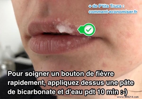 Fast Cold Sore Relief: Baking Soda Paste Home Remedy That Works