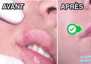 Fast Cold Sore Relief: Baking Soda Paste Home Remedy That Works