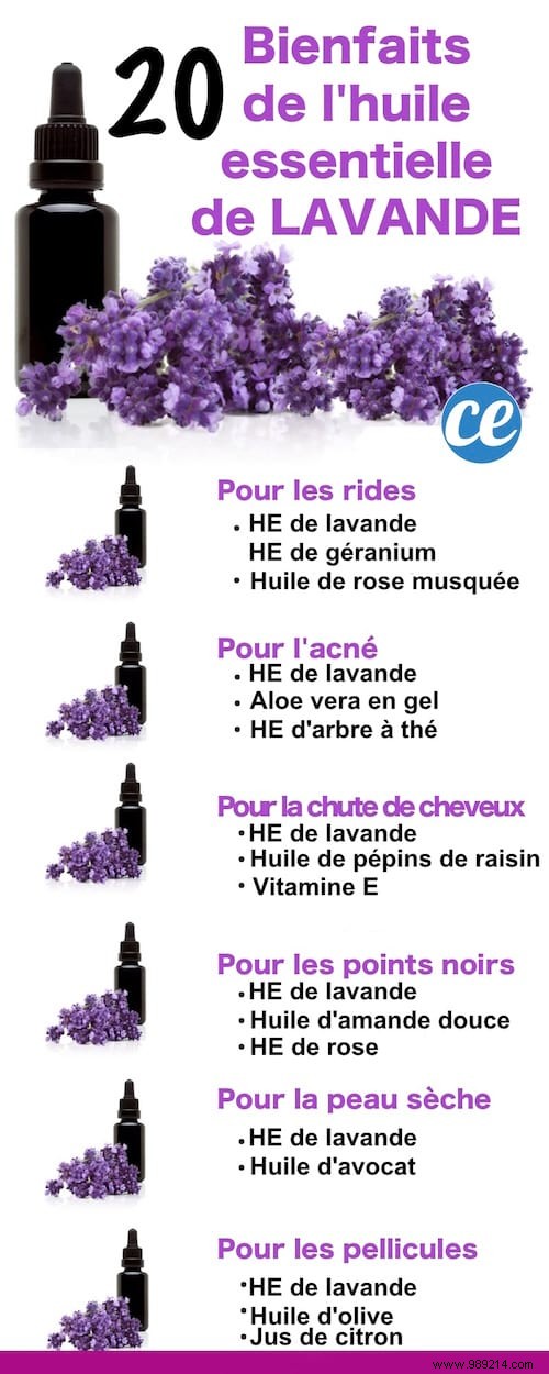 21 Proven Lavender Essential Oil Uses for Skin, Hair, and Everyday Wellness
