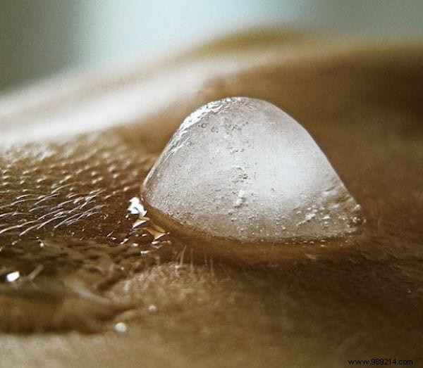 Soothe Sunburn Fast: White Vinegar Ice Cubes and Proven Home Remedies