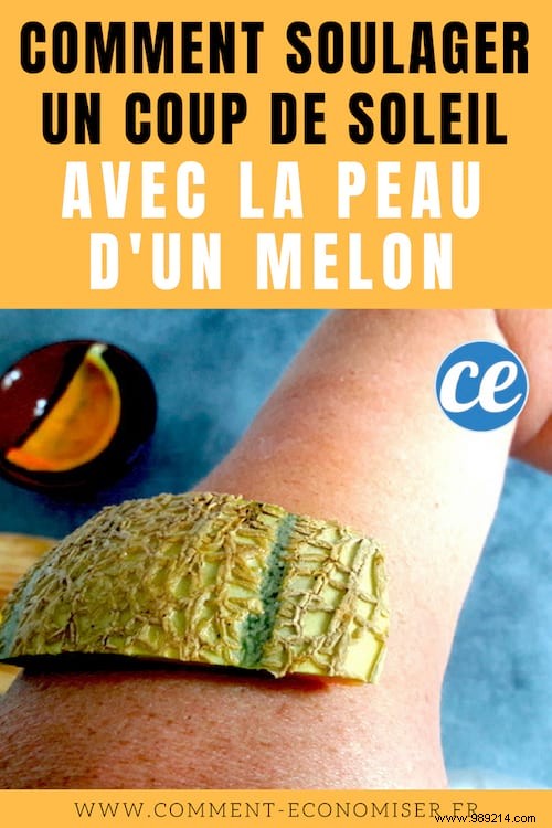 Soothe Sunburn Naturally: Proven Melon Rind Remedy to Relieve Pain and Prevent Blisters