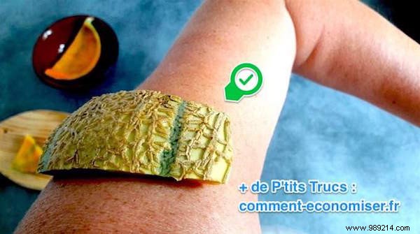 Soothe Sunburn Naturally: Proven Melon Rind Remedy to Relieve Pain and Prevent Blisters