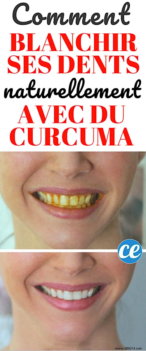 How to Whiten Yellow Teeth Naturally with Turmeric: A Proven Home Remedy
