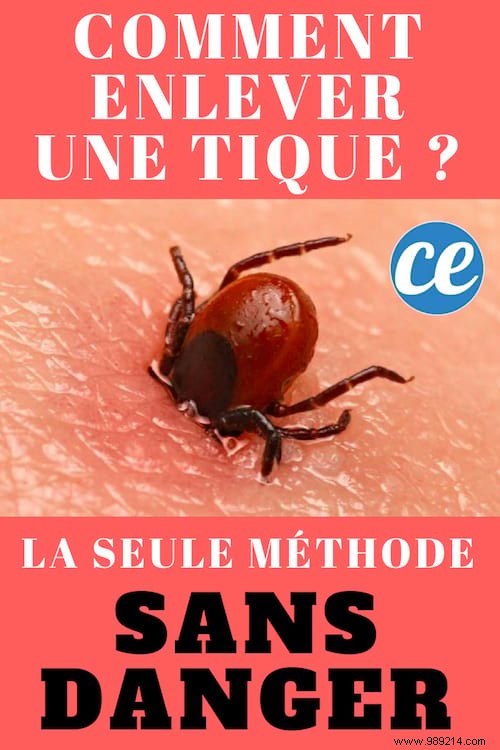 Safely Remove Ticks: The Expert-Recommended Method to Avoid Disease Risk