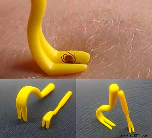 Safely Remove Ticks: The Expert-Recommended Method to Avoid Disease Risk