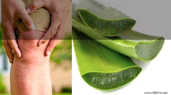 Fast Natural Relief for Muscle Aches: Aloe Vera and Black Sesame Oil Massage