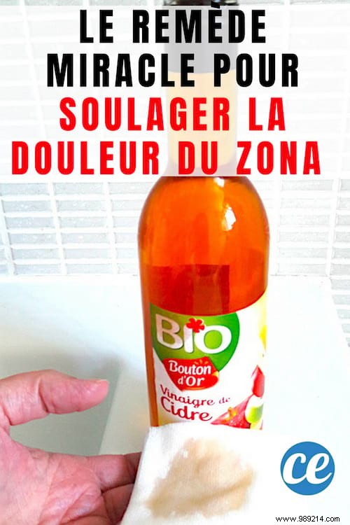 Relieve Shingles Pain Naturally: Apple Cider Vinegar Home Remedy