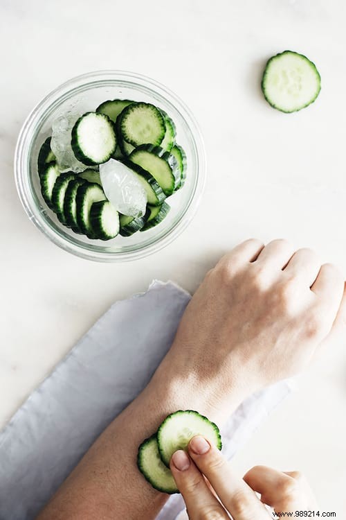 5 Proven Natural Remedies to Instantly Soothe Mosquito Bites