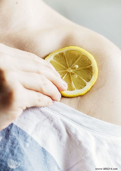 5 Proven Natural Remedies to Instantly Soothe Mosquito Bites