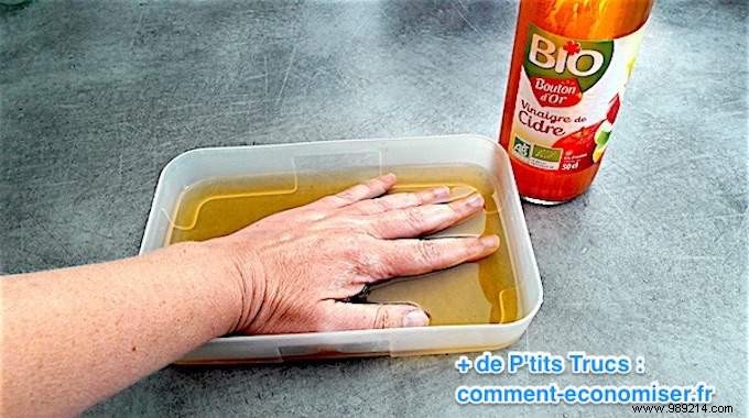 Relieve Eczema Itching Naturally: A Nurse s Proven Apple Cider Vinegar Remedy