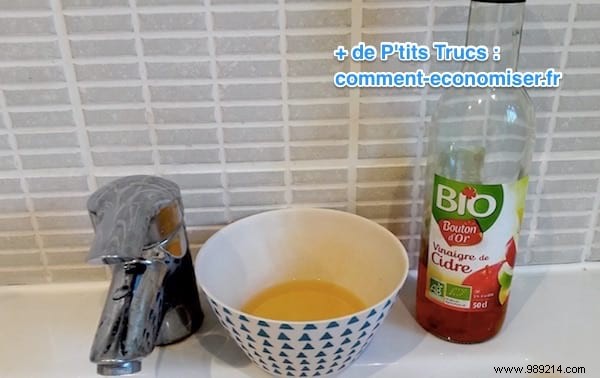 Relieve Eczema Itching Naturally: A Nurse s Proven Apple Cider Vinegar Remedy