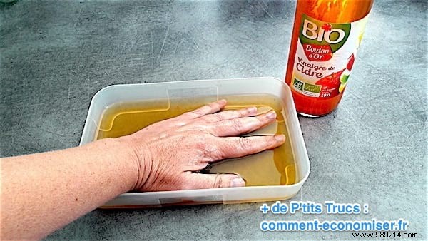Relieve Eczema Itching Naturally: A Nurse s Proven Apple Cider Vinegar Remedy