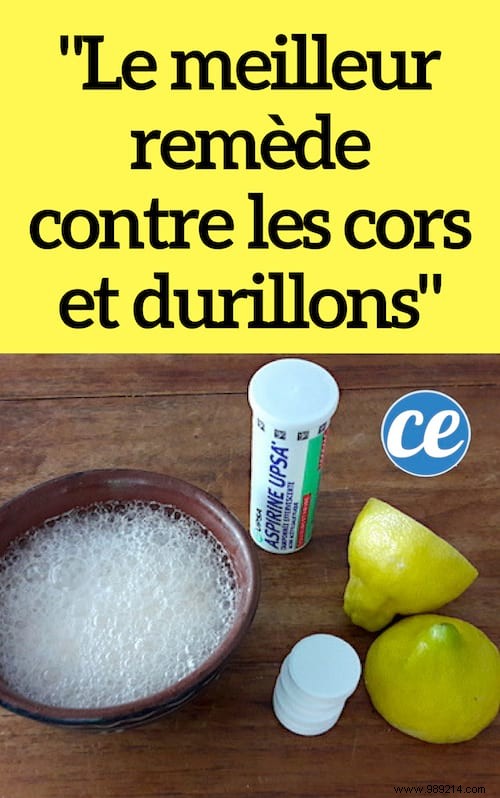 Proven Natural Remedy for Corns and Calluses: Aspirin and Lemon Juice