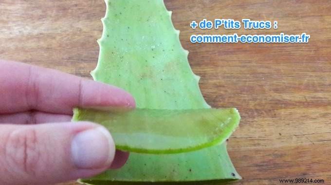 Heal Cold Sores Fast: Proven Aloe Vera Remedy for Quick Relief