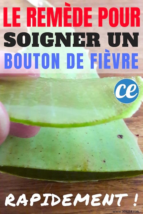 Heal Cold Sores Fast: Proven Aloe Vera Remedy for Quick Relief