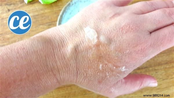 Fade Age Spots Naturally: Grandma s Time-Tested Aloe Vera and Castor Oil Remedy