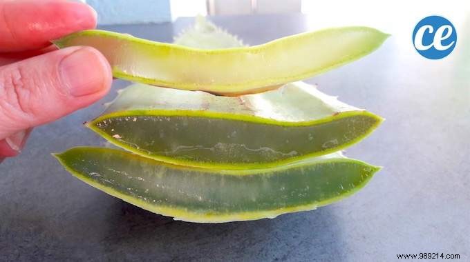 Soothe Sunburn Naturally: Use Fresh Aloe Vera for Hydration and Relief