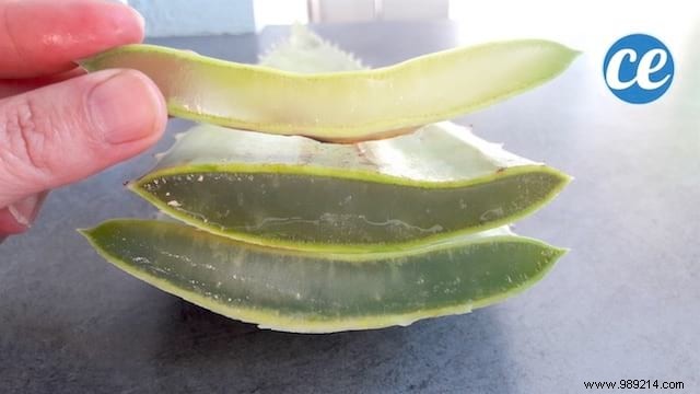 Soothe Sunburn Naturally: Use Fresh Aloe Vera for Hydration and Relief