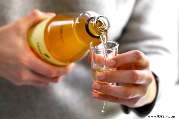 12 Proven Natural Remedies to Eliminate Dandruff Effectively