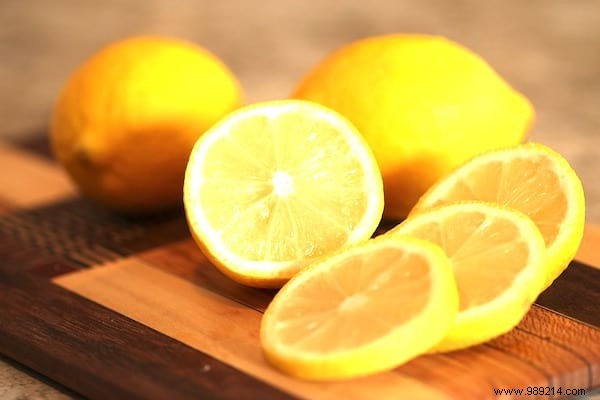 12 Proven Natural Remedies to Eliminate Dandruff Effectively