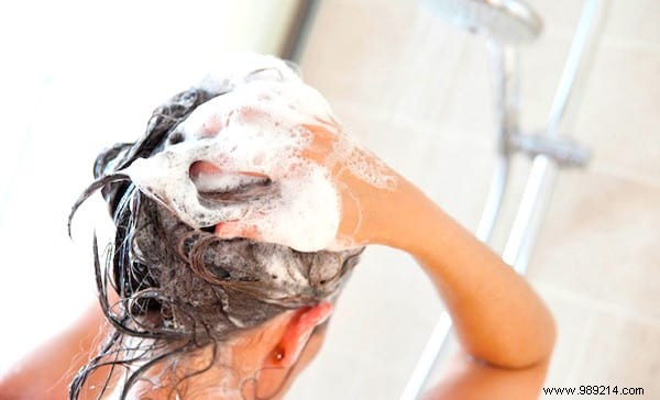 12 Proven Natural Remedies to Eliminate Dandruff Effectively
