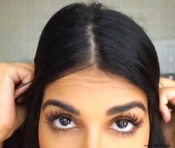 12 Proven Natural Remedies to Eliminate Dandruff Effectively