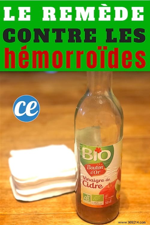 Natural Hemorrhoid Relief: Apple Cider Vinegar – A Trusted Grandma s Remedy